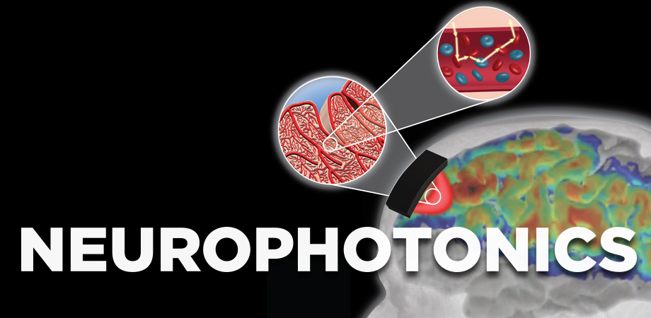 Techniques for imaging of the human brain are making rapid advances. Credit: SPIE Neurophotonics.