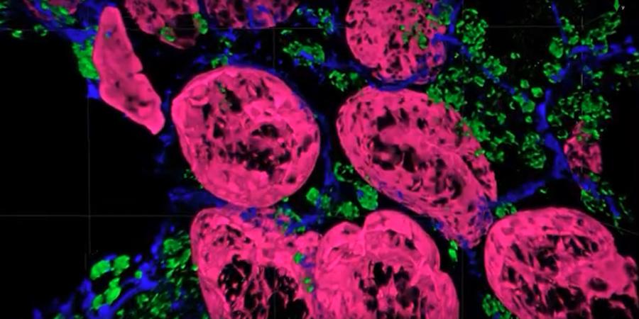 Unprecedented views of the interior of cells and other nanoscale structures are now possible thanks to innovations in expansion microscopy. Credit: Carnegie Mellon University.