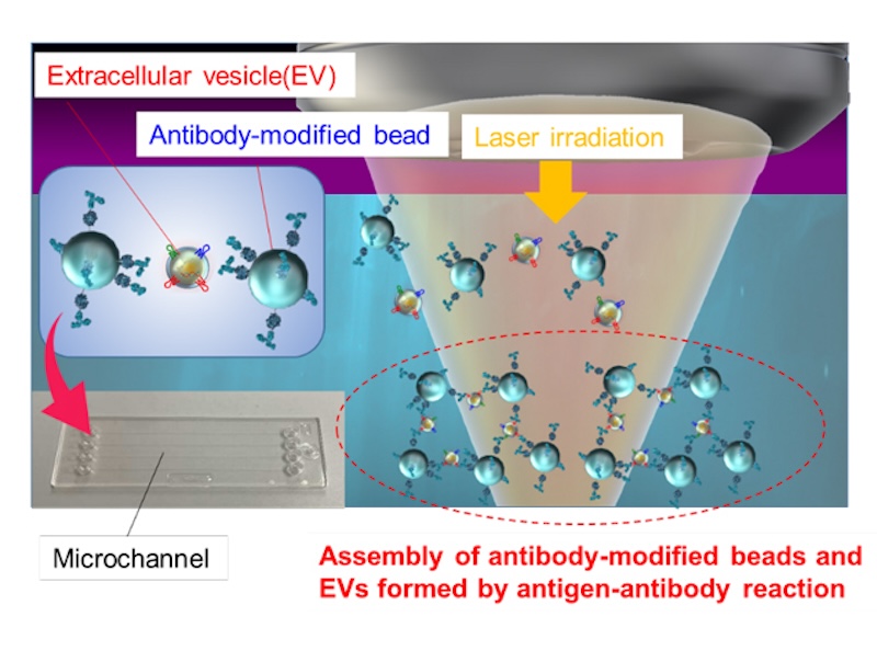 Schematic diagram of light-induced assembly of extracellular vesicles (EV). Using laser irradiation, the researchers managed to directly detect nanoscale EVs in a cell supernatant within minutes. Credit: Takuya Iida/Osaka Metropolitan University.