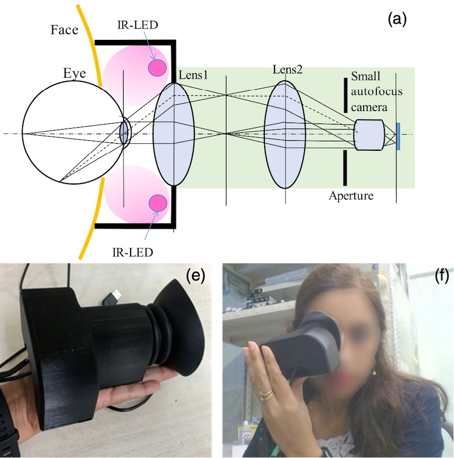 Basic optical design of the fabricated wide-field fundus camera, and photograph showing the self-imaging capability of the fundus camera. Credit: Tohoku University/SPIE.