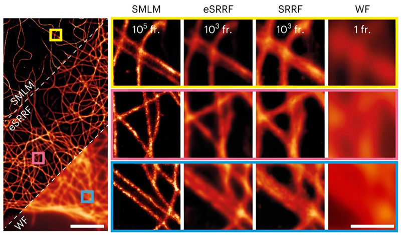 Super-resolved reconstruction images from eSRRF and SRRF obtained from 1,000 frames of high-density fluctuation data (12.1 localizations per frame and &mu;m2), created in silico from an experimental sparse-emitter dataset (DNA-PAINT microscopy of immunolabeled microtubules in fixed COS-7 cells, 0.121 localizations per frame and &mu;m2). 

The SMLM reconstruction obtained from the sparse data and the WF equivalent are shown for comparison. The number of frames used for reconstruction is indicated in each column (FRC resolution estimate, SMLM 71 &plusmn; 2 nm, eSRRF 84 &plusmn; 11 nm, SRRF 112 &plusmn; 40 nm, WF 215 &plusmn; 20 nm). Scale bars, 1 &mu;m (a, and insets in c) and 5 &mu;m (c, left). FRC is shown as mean &plusmn; s.d.
