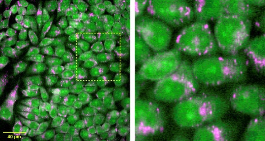 The extra speed makes it possible to acquire large-area hyperspectral images of living cells, such as the ones seen here. Credit: Katsumasa Fujita/Osaka University