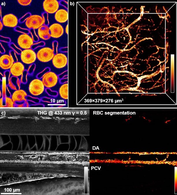 (a) TSFG image of isolated human red blood cells. (b) 3D rendering of blood vessels from volumetric TSFG imaging. (c) THG image of the trunk of a living zebrafish embryo revealing different structures in addition to RBCs. Credit: J&uacute;lia Ferrer Ortas et al/&Eacute;cole Polytechnique. 