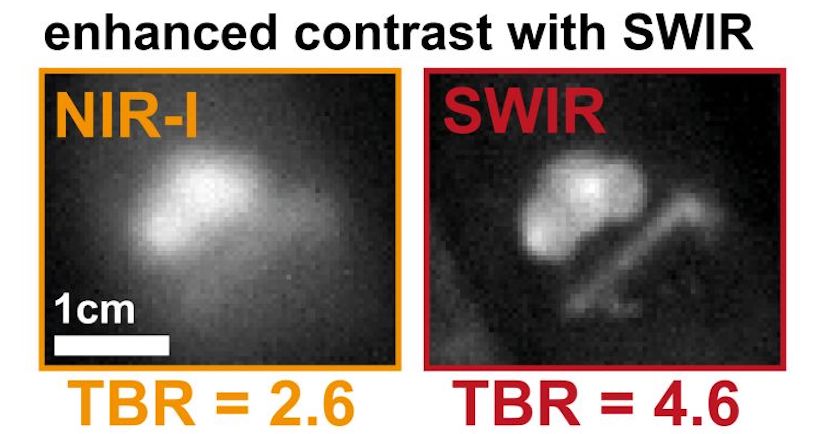 SWIR delivers enhanced contrast and improved tumor-to-background signal ratio from tumor tissues. Credit: UCL/Laura Privitera LinkedIn.