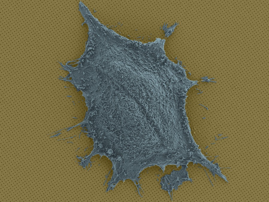 A single cell on a chip. Observing cell secretions can reveal details of cell behavior. Credit: BIOS/EPFL.