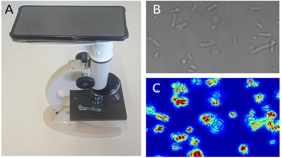 Antibiotic susceptibility testing using a low cost microscope and a mobile phone. Credit: Ines Villalba/EPFL.