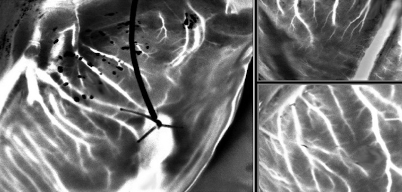 A powerful tool for imaging donor hearts, laser speckle captures detailed images of blood vessels in a beating heart outside the body. Credit: Paris-Saclay University.