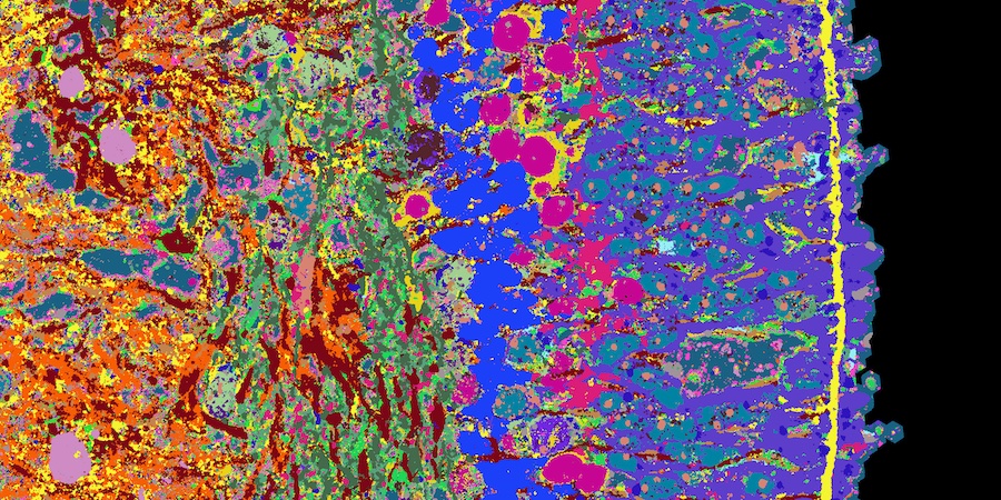 Detail of a cross-section of a retinal organoid. Different tissue structures are made visible with different colours. Credit: ETH Zurich/Nature Biotechnology.