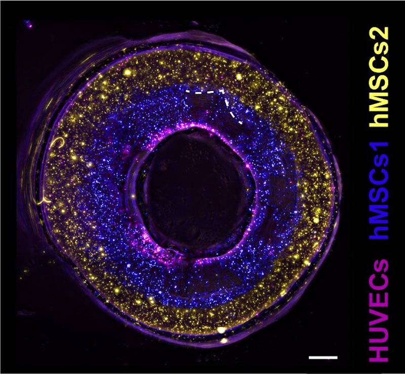 Cross-section of a bioprinted vessel with epithelial cells (purple) and two types of stem cells (blue, yellow) to mimic the layers of a blood vessel wall. (Scale bar 500 &mu;m). Credit: LevatoLab, UMC Utrecht.