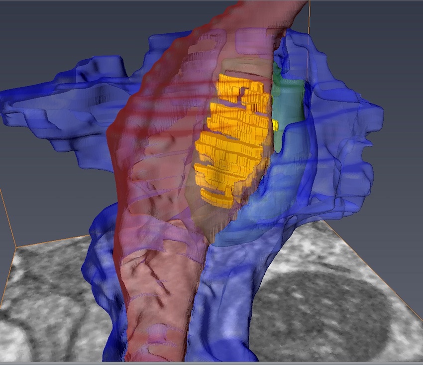 See-through 3D model that shows the axon (red), medium spinal motor neuron (green), and astrocyte (blue) converging at the synapse (yellow). Credit: University of Rochester/CTN.