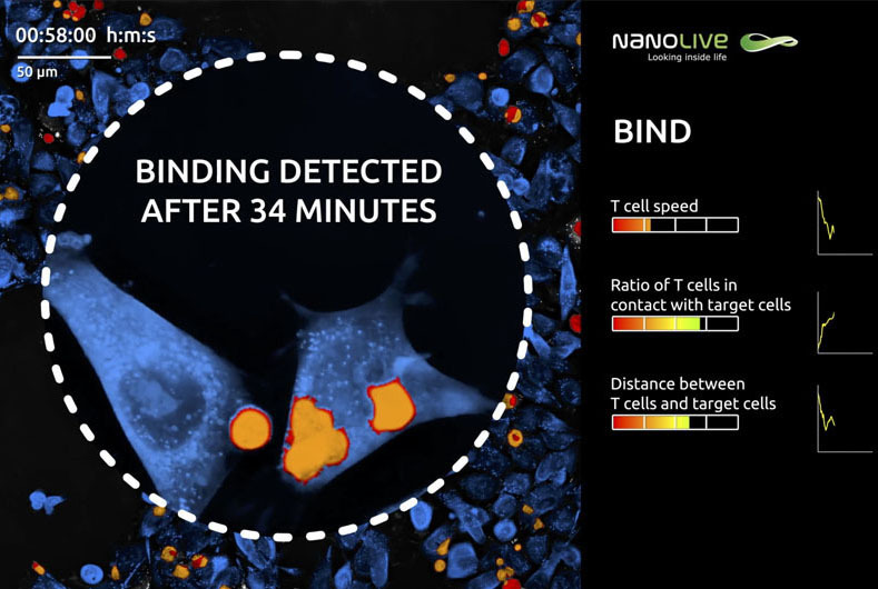 Observing and analyzing T cells attack cancer cells in real time. Image: Nanolive.
