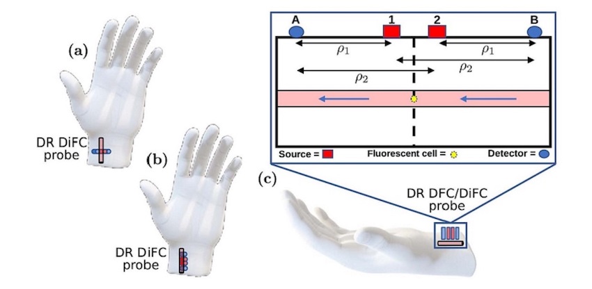 The dual-ratio (DR) diffuse in-vivo flow cytometry (DiFC) is a novel technique that uses two laser sources and two detectors to mitigate the effects of noise and autofluorescence, which may enable doctors to precisely detect fluorescent tags attached to circulating tumor cells in the bloodstream. Credit: Tufts/Northeastern.