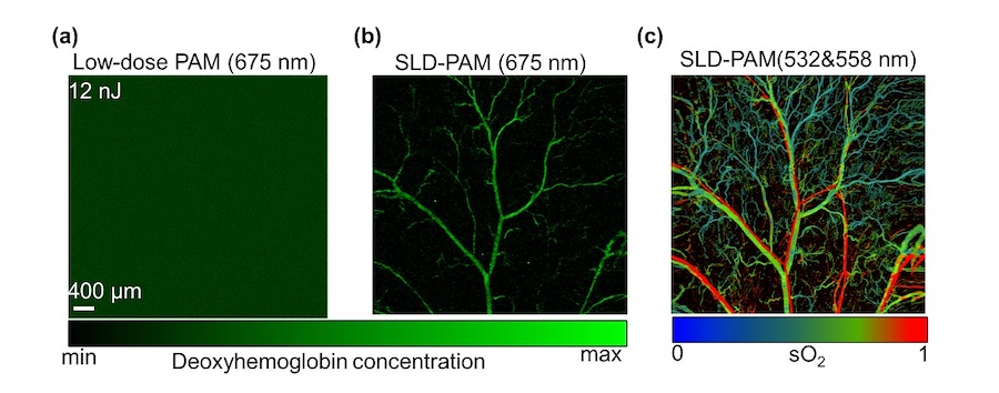 Image comparison of the in vivo results of (a) Low-dose PAM and (b) SLD-PAM , both at super-low pulse energy with a red-light source, and (c) oxygen saturation image SLD-PAM acquired via dual-wavelength spectrum unmixing. Credit: CityU.
