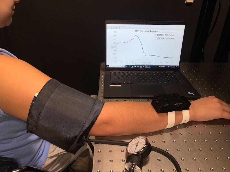 Researchers developed a wearable wrist-worn device that uses laser speckle imaging to catch early signs of postpartum hemorrhage. Credit: Francesca Bonetta-Misteli/WUSTL.