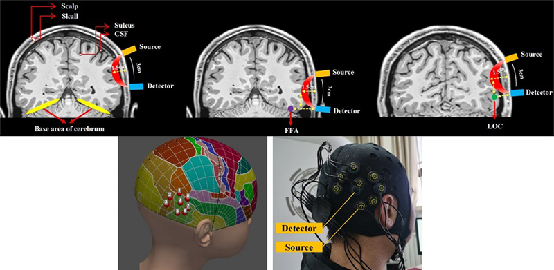 <cap>Functional near-infrared spectroscopy (fNIRS) can be performed using a portable emitter and detector placed on the scalp near a region of interest in the brain. By emitting and sensing light at specific frequencies, one can use fNIRS to detect changes in hemoglobin concentration, which correspond to brain activity. A transcranial brain atlas aids 3D localization for configuring optimal target channels. Image credit: W. Chai, P. Zhang, et al., doi 10.1117/1.NPh.11.1.015002.