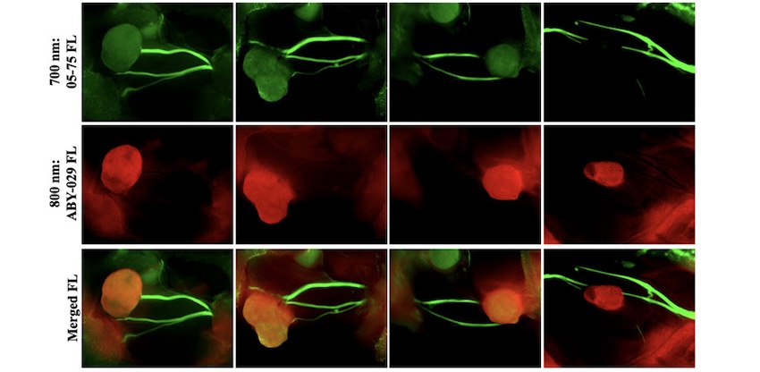 Two-color fluorescence nerve and tumor visualization, with green color for the 700-nm LGW05-75 imaging channel (top) and red color for the 800-nm ABY-029 imaging channel (middle row), and with the 700- and 800-nm fluorescence images merged (bottom). Credit: OHSU/JBO.
