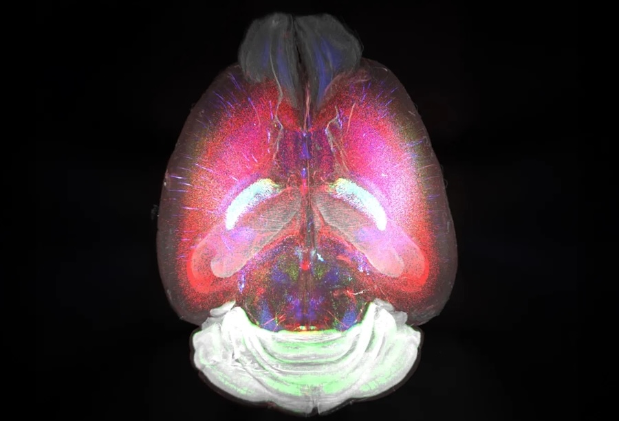 Eight-week-old mouse brain. Credit: Karolinska Institutet/Science.