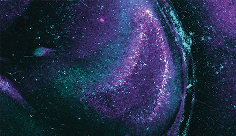 The researchers delivered genes for light-sensitive proteins to hippocampal slices, seen here, to observe seizure-like neuron activity. Credit: UC Santa Cruz/Nature Neuroscience.