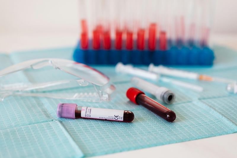 Different stages of cancer could be identified in blood samples. Credit: Kaboompics stock image.