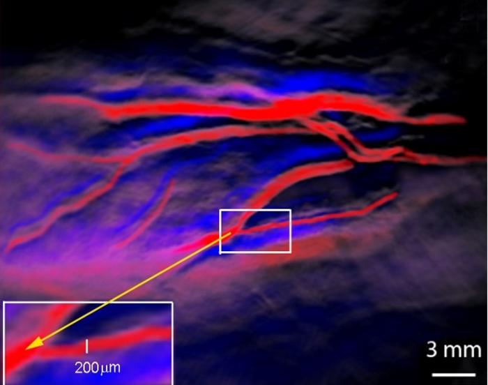 Researchers at OU Health Stephenson Cancer Center are studying a promising new imaging technique that could improve pancreatic cancer surgery. Pictured, the technique can distinguish arteries (red) and veins (blue) at the level of 200 microns, the width of a human hair. The same enhanced detection would be possible for cancer cells. Credit: University of Oklahoma.