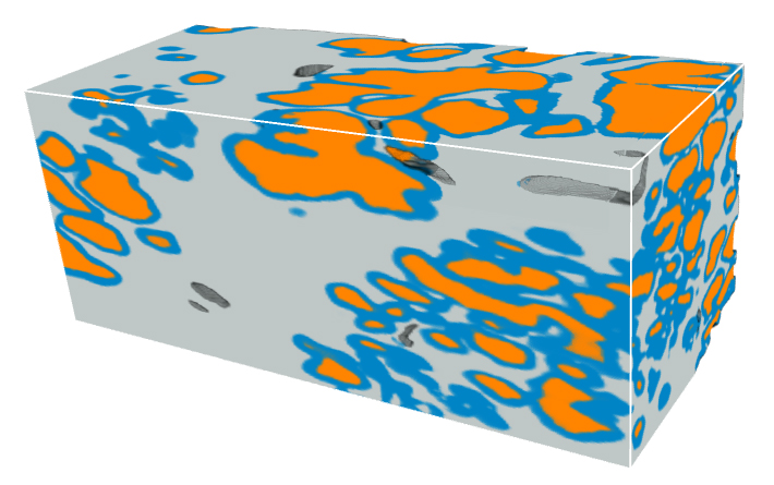 Microscopic glands of the prostate are segmented (colored) with the new deep-learning pipeline; the image shows a prostate cancer tissue volume, measuring roughly 1x1x2 mm in size. The prostate glands form a branching-tree network; orange regions represent the lumen (interior) of the glands, blue regions represent the epithelium (edges) of the glands, and gray regions are the surrounding stroma. The morphology of prostate glands, as viewed on 2D histology slides, is currently the basis for determining how aggressive a cancer is (prognostication), and what treatments are required for individual patients. Accurately segmenting and characterizing these glands in 3D within the context of large 3D pathology datasets has the potential to improve these prognostic determinations and critical treatment decisions. Credit: Rui Wang, University of Washington.