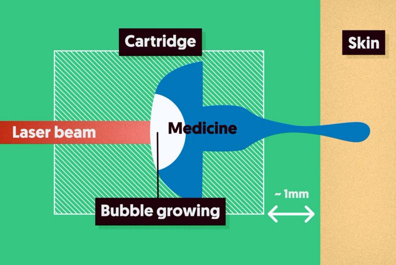FlowBeam's novel approach focuses on delivering small volumes (less than 0.1 mL) into the superficial layers of skin, which cancan contribute to better and personalised treatments.