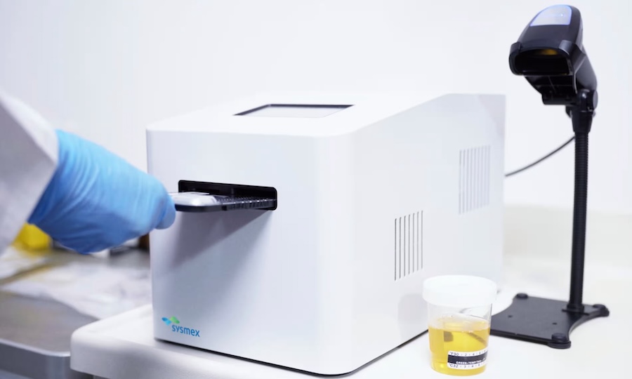 Health workers can identify infections by placing a 400-microlitre urine sample on a phone-sized cartridge which slots into a shoebox-sized analyser unit. Credit: Sysmex Astrego.