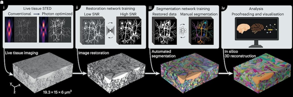 LIONESS technology examining living human cerebral tissue. Optical improvements, deep-learning training and analysis (top) flow into individual processing steps (bottom). Credit: ISTA/Nature Methods.