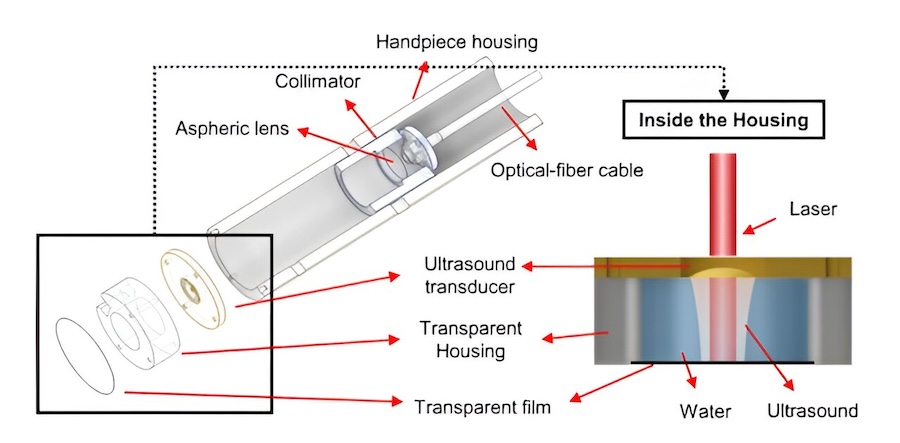 Conceptual diagram of the ULTRA-PTT handpiece. Credit: DGIST/Advanced Optical Materials.