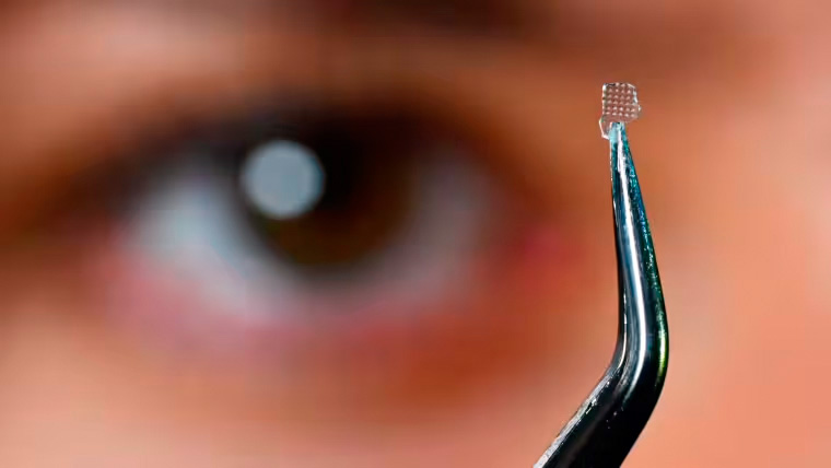 Researchers at Friedrich Schiller University Jena have developed an optical lens from 