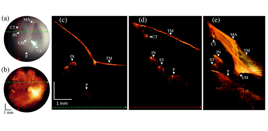 Otoscope and OCT images acquired from normal ear using the new device, offering a clearer and more comprehensive view. Credit: USC/JBO.
