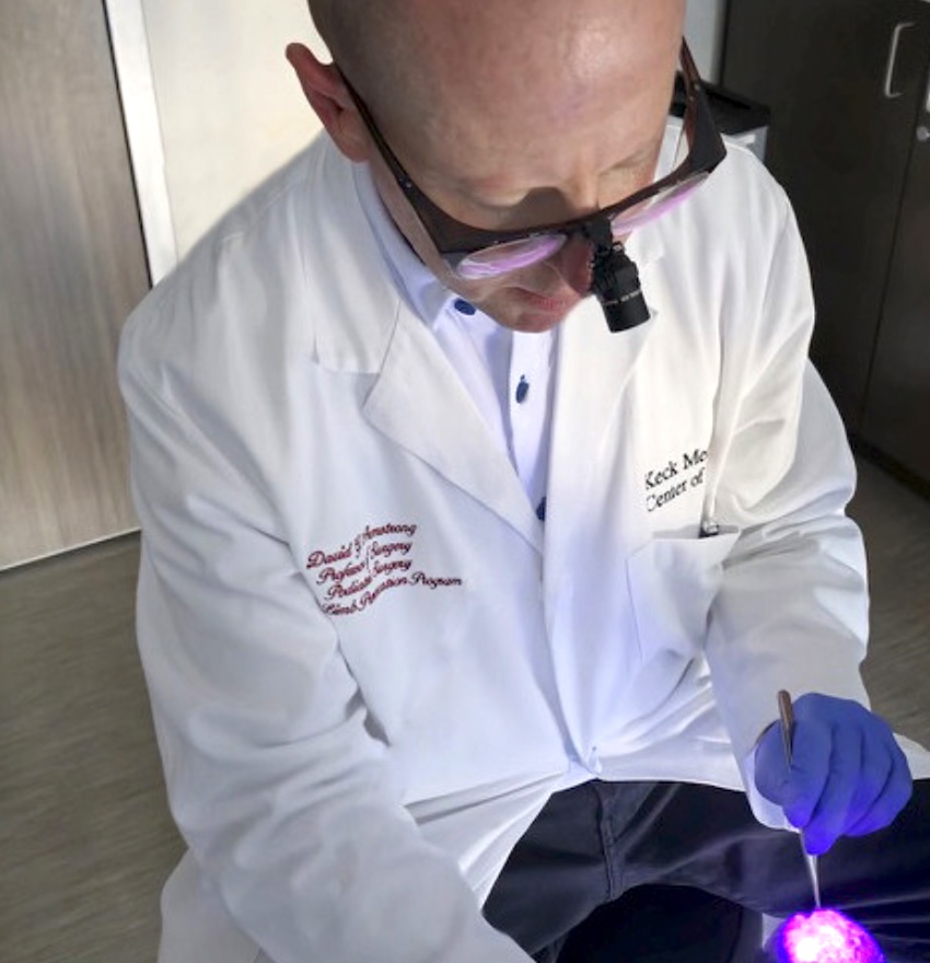 David G. Armstrong, a podiatric surgeon and limb preservation specialist with Keck Medicine of USC, uses AF imaging to debride a wound. Credit: David Armstrong.