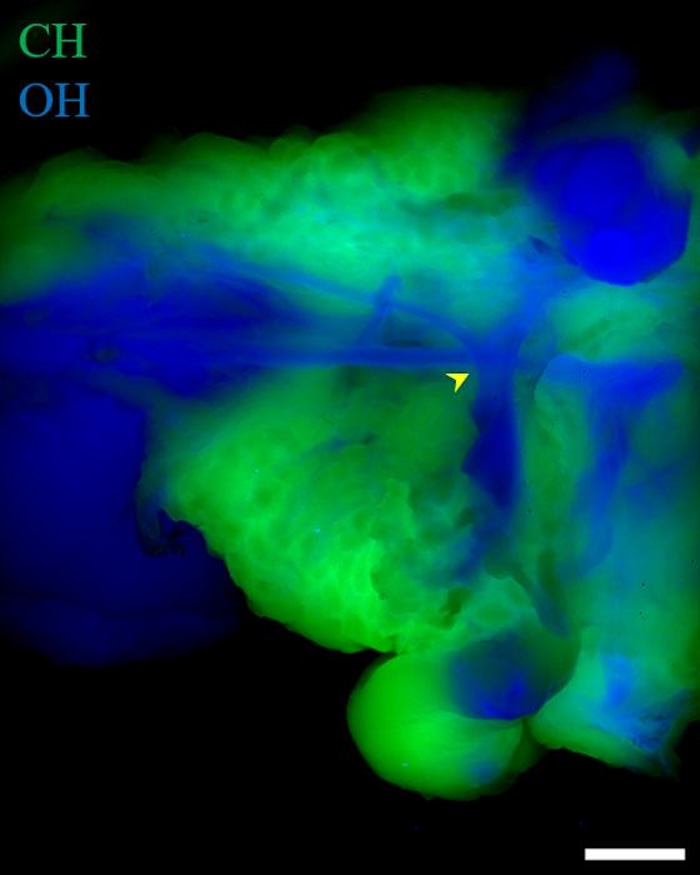 SWIR Raman imaging of the areas with OH and CH chemical bonds in a surgical model of a facial nerve embedded in adipose tissue. Credit: Bernardo Arus/FBOO/NCT Dresden.