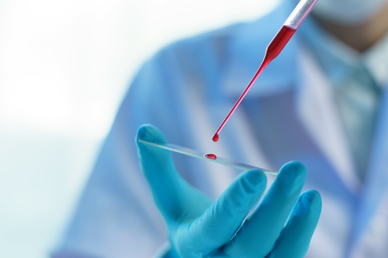 Data from liquid biopsies could accelerate detection of disease. Credit: stock photo via Aston University.