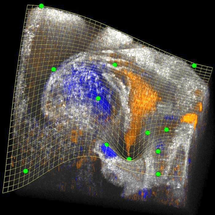 The clipping spline provides unprecedented capabilities to see inside 3D images. The clipping spline (mesh) is defined by the control points (green) and provides a smooth cutaway view into the looping embryonic mouse heart, revealing the blood flow (orange and blue) in the heart's atrium and ventricle. Credit: Andre C. Faubert and Shang Wang, Stevens Institute of Technology.