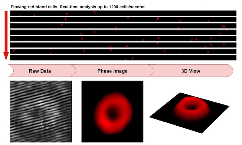 Flowing red blood cells (RBCs) are imaged under the high-throughput QPM. The raw interferogram is processed to obtain the phase image of each individual RBC. The 3D information is analyzed to examine the features of cells. Credit: Biophotonics Discovery/Duke University. 