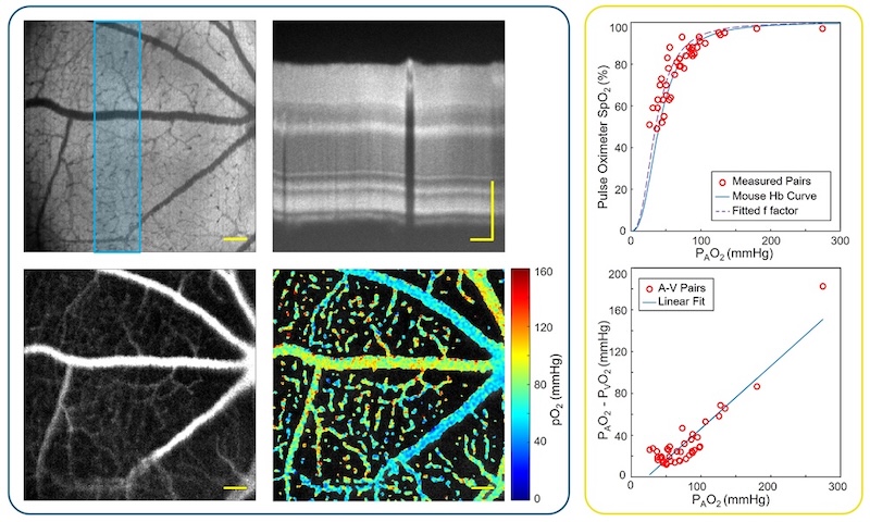 The new multimodal system combines visible light optical coherence tomography (VIS-OCT) with phosphorescence lifetime ophthalmoscopy (PLIM-SLO) to capture detailed structural images alongside quantitative oxygen partial pressure (pOâ‚‚) measurements. Credit: Johns Hopkins University/Neurophotonics.