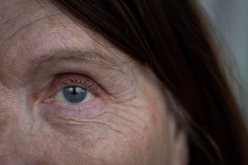 A rise in temperature triggers beneficial protein repair in the retina. Credit: Matti Ahlgren/Aalto University.