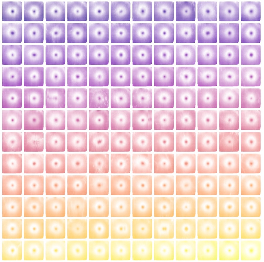 Multiple retinal maps of single eyes with white indicating where the retina is thickest and coloured areas representing thinner regions of the retina. The research identified 294 genes influencing the contours of these retinal maps and pinpointed specific areas of the maps linked to disease. Credit: WEHI.