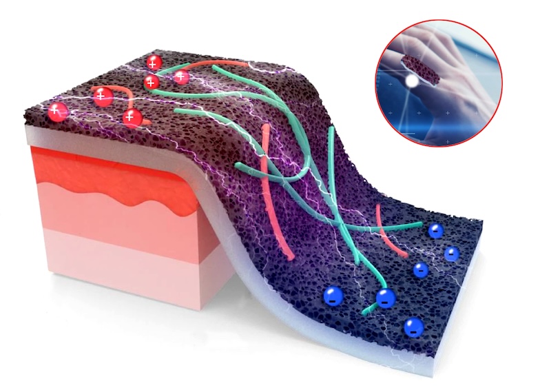 The flexible sensor, ideal for use in the human body, uses laser-induced graphene to simultaneously but separately measure temperature and strain, potentially enabling better wound healing monitoring by providing clearer insights into inflammation and recovery. Credit: Jennifer M. McCann.