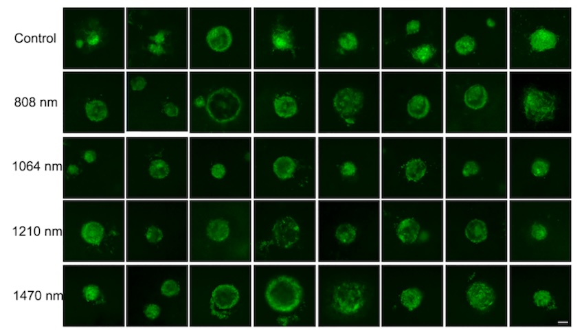 TPEF microscopy images of the 3D cultured cells 4 weeks after irradiation with 808, 1064, 1210, and 1470 nm light at a laser doses of 10 J/cm2. 8 different TPEF images were randomly acquired from each group. The scale bar is 100 microns. Credit: Biomedical Optics Express.