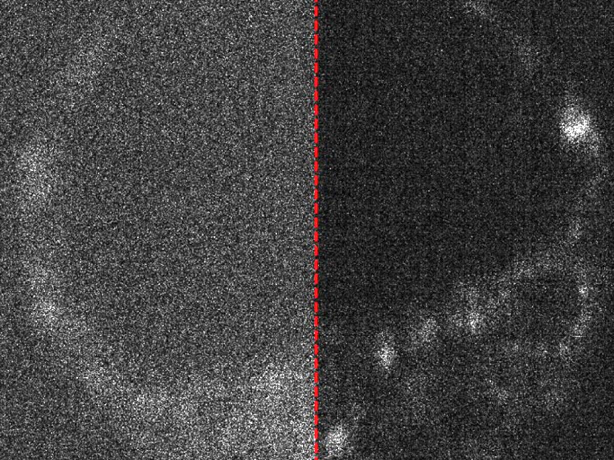 Image of a live mouse embryo with and without optimised capture. Credit: University of Adelaide.
