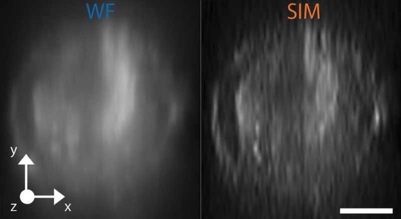 Left: standard widefield image of cell. Right: the improvement from reconstructed structured illumination microscopy. Credit: CNR/Scientific Reports.