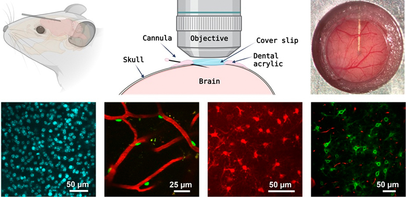 The newly developed cannula system delivers imaging agents directly to the brain without obstructing the optical path for high-resolution deep tissue imaging. Validation of the system involved delivering and imaging fluorescent markers for various cell types and structures in the brain. Credit: S. S. Hou / Massachusetts General Hospital.