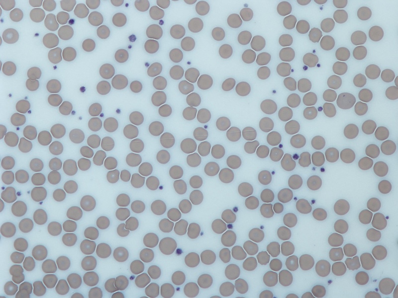 Platelets (small purple dots) surrounded by red blood cells. Credit: Dr Graham Beards/Wikimedia Commons.