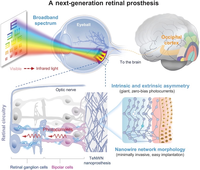 Tellurium possesses broad-spectrum optical absorption from visible to infrared light (top left). A subretinal-implanted tellurium nanoprosthesis replaces activates residual retinal circuitry (bottom left) and the occipital cortex (top right). Minimally invasive easy implantation is achieved by asymmetry engineering and nanowire network morphology (bottom right). Together, these properties make tellurium nanowire networks (TeNWNs) the next generation of visual prosthesis technology. Credit: Science/Fudan University.