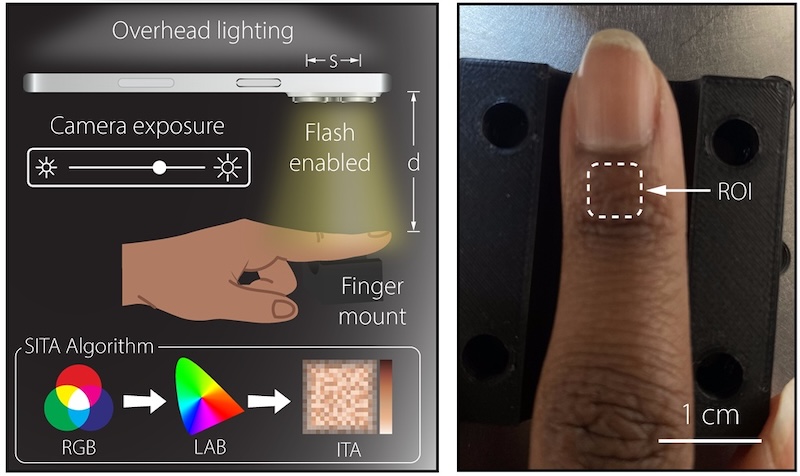 Proposed smartphone colorimeter measures at a common anatomical site (ROI) for pulse oximetry. By capturing images of the skin and calculating a standardized color metric known as the individual typology angle (ITA), the team showed that smartphones can produce accurate skin-tone readings comparable to those of expensive clinical devices. Credit: J. A. Burrow/Morgan State and Brown University.