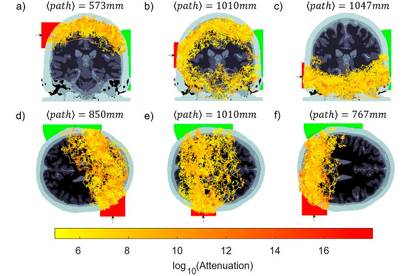 <cap 1>Detecting photons through an entire adult head explores the limits of photon transport in the brain, for access to regions of the brain currently inaccessible with noninvasive optical brain imaging. Credit: J. Radford et al., doi 10.1117/1.NPh.12.2.025014.