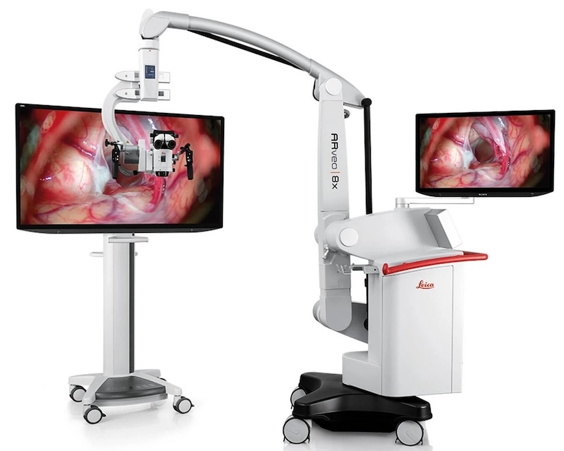ARveo 8 with optional 55-inch 4K 3D cart-mounted monitor, microscope-mounted 31-inch 4K 3D monitor, and 2-in-1 image display system for the graphical user interface as well as for an additional microscope image display on the microscope tower.
Credit: Leica.