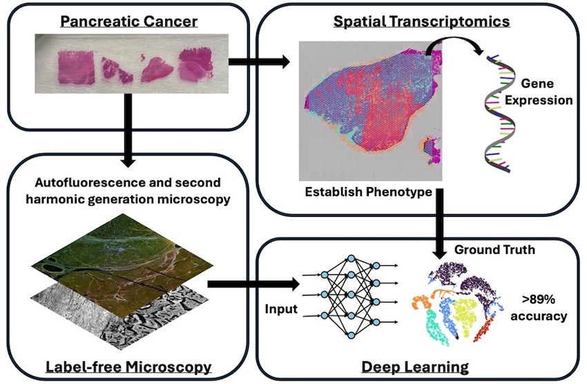 Researchers have developed a new method for pancreatic cancer phenotyping using label-free optical microscopy coupled with a deep learning artificial intelligence algorithm. Using this approach, it was possible to identify tissue phenotypes defined by spatial transcriptomics to over 89% accuracy using label-free microscopy images alone. Credit: T. Sawyer/University of Arizona/Biophotonics Discovery.